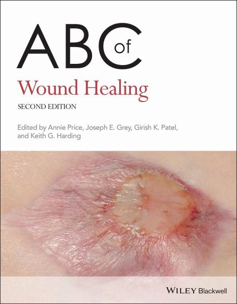 ABC of Wound Healing (eBook, ePUB) ABC of Wound Healing (eBook, ePUB)