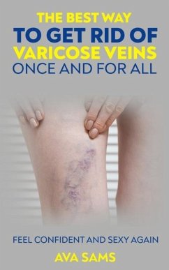 Cover The Best Way to Get Rid of Varicose Veins Once and For All