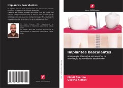 Implantes basculantes - Sharma, Mohit;Bhat, Geetha K