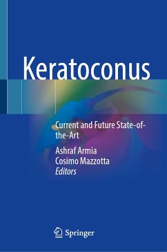 Keratoconus (eBook, PDF)