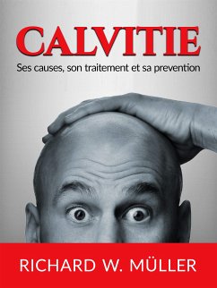 Calvitie (Traduit) (eBook, ePUB) - Richard Müller, W.