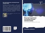 Vnutricherepnaq angiomatoznaq meningioma