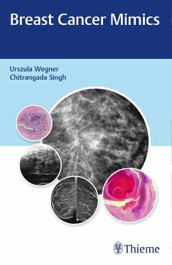 Breast Cancer Mimics - Wegner, Urszula;Singh, Chitrangada