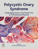 Polycystic Ovary Syndrome (eBook, ePUB)