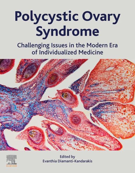 Polycystic Ovary Syndrome (eBook, ePUB) Polycystic Ovary Syndrome (eBook, ePUB)