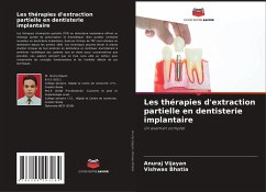 Les thérapies d'extraction partielle en dentisterie implantaire - Vijayan, Anuraj;Bhatia, Vishwas