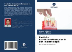 Partielle Extraktionstherapien in der Implantologie - Vijayan, Anuraj;Bhatia, Vishwas