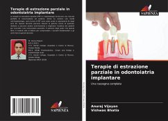 Terapie di estrazione parziale in odontoiatria implantare - Vijayan, Anuraj;Bhatia, Vishwas