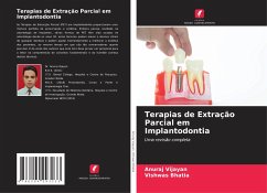 Terapias de Extração Parcial em Implantodontia - Vijayan, Anuraj;Bhatia, Vishwas