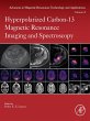 Hyperpolarized Carbon-13 Magnetic... - Bild 1