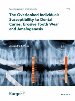 The Overlooked Individual: Susceptibility to Dental Caries, Erosive Tooth Wear and Amelogenesis - Vieira, Alexandre Rezende