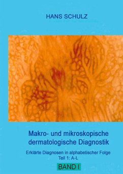 Makro- und mikroskopische dermatologische Diagnostik - Schulz, Hans