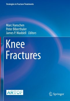 Knee Fractures (eBook, PDF)