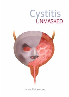 Cystitis unmasked (eBook, ePUB) - Malone-Lee, James