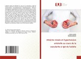 Atteinte rénale et hypertension artérielle au cours de la vascularite à IgA de l'adulte