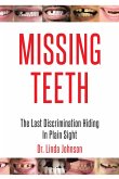 Missing Teeth (eBook, ePUB)