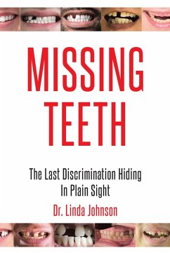 Missing Teeth (eBook, ePUB) - Johnson, Linda