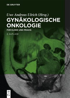Cover Gynäkologische Onkologie (eBook, ePUB)