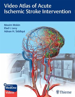 Video Atlas of Acute Ischemic Stroke Intervention - Mokin, Maxim;Levy, Elad;Siddiqui, Adnan