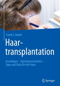 Haartransplantation - Neidel, Frank G.