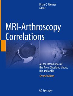 MRI-Arthroscopy Correlations