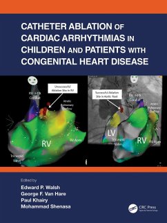 Catheter Ablation of Cardiac Arrhythmias in Children and Patients with Congenital Heart Disease (eBook, PDF)