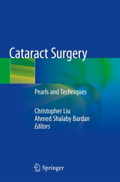 Cataract Surgery