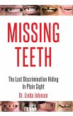 Missing Teeth