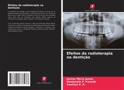 Efeitos da radioterapia na dentição - James, Jesline Merly;Puranik, Manjunath P.;K. R., Sowmya