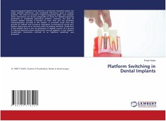 Platform Switching in Dental Implants - Yadav, Preeti