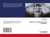 Effects of radiotherapy on dentition