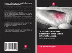 Lúpus eritematoso sistêmico, uma visão estomatológica - Alemán Miranda, Otto