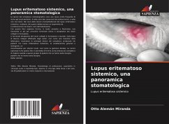 Lupus eritematoso sistemico, una panoramica stomatologica - Alemán Miranda, Otto