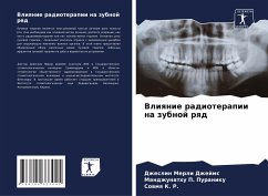 Vliqnie radioterapii na zubnoj rqd - Dzhejms, Dzheslin Merli;Puraniku, Mandzhunathu P.;K. R., Sowmq
