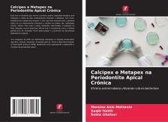 Calcipex e Metapex na Periodontite Apical Crónica - Motiwala, Momina Anis;Habib, Saqib;Ghafoor, Robia