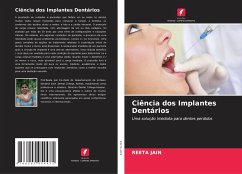 Ciência dos Implantes Dentários - Jain, Reeta