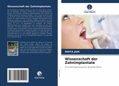 Wissenschaft der Zahnimplantate - Jain, Reeta