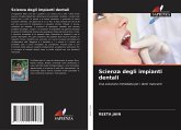 Scienza degli impianti dentali