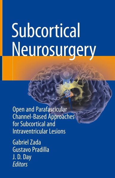 Subcortical Neurosurgery