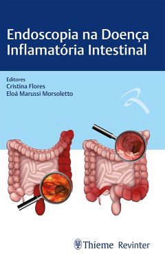 Endoscopia na Doença Inflamatória Intestinal (eBook, ePUB) - Flores, Cristina; Morsoletto, Eloa Marussi