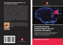 Transformação hemorrágica de um enfarte cerebral - Shalyakina, Nadezhda