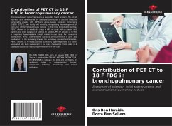 Contribution of PET CT to 18 F FDG in bronchopulmonary cancer - Ben Hamida, Ons;Ben Sellem, Dorra