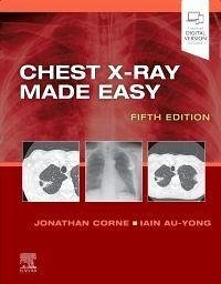 Chest X-Ray Made Easy - Corne, Jonathan, MA, PhD, MB BS, FRCP (Consultant Respiratory Physic; Au-Yong, Iain (Consultant Thoracic, Head and Neck and General Radiol