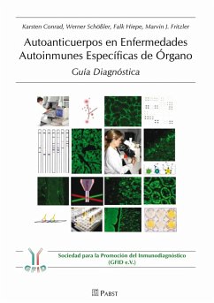 Autoanticuerpos en Enfermedades Autoinmunes Específicas de Órgano - Guía Diagnóstica (eBook, PDF) - Conrad; Fritzler, Karsten; Hiepe, Marvin J; Schößler, Falk; Werner