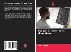 Imagem de tumores de rhino-sinus - Mezri, Sameh