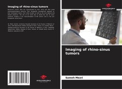 Imaging of rhino-sinus tumors - Mezri, Sameh