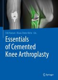 Essentials of Cemented Knee Arthroplasty (eBook, PDF)