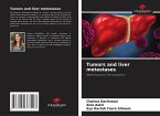 Tumors and liver metastases