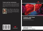 Tumors and liver metastases