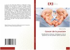 Cancer de la prostate